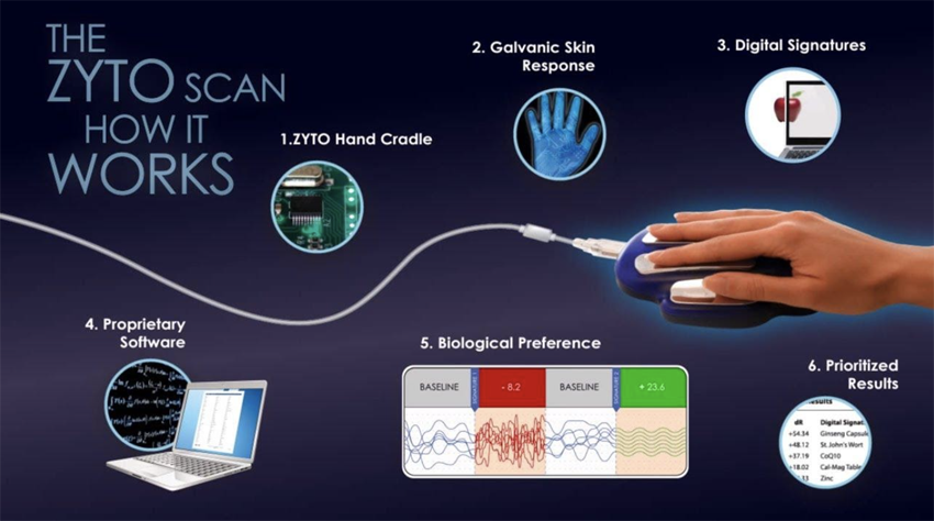 zyto-scan-and-how-does-it-work